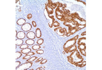 Antibodies for diagnostics
